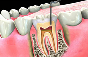 Endodontics